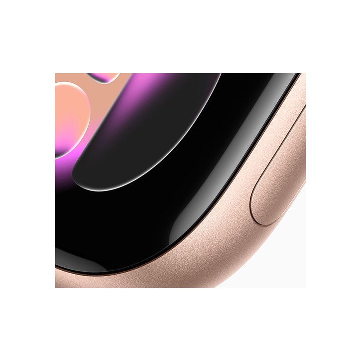 שעון חכם אפל Apple Watch Series 11 GPS + Cellular – גודל 42 מ''מ – צבע